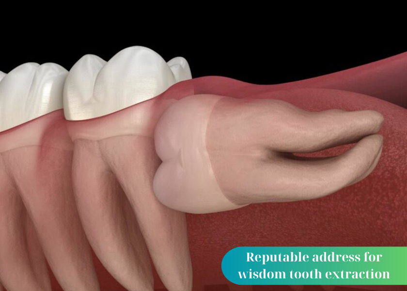 Is wisdom tooth extraction painful?