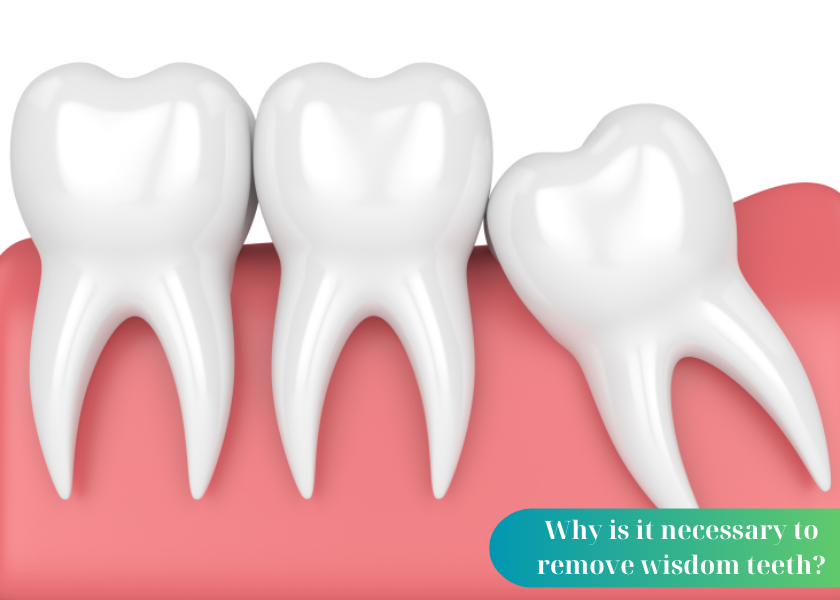 6 things to note before wisdom tooth extraction