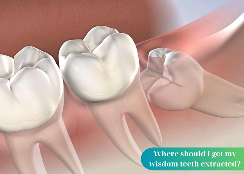 Where should I get my wisdom teeth extracted?
