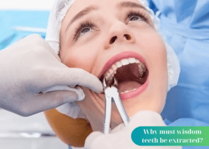 Why must wisdom teeth be extracted?