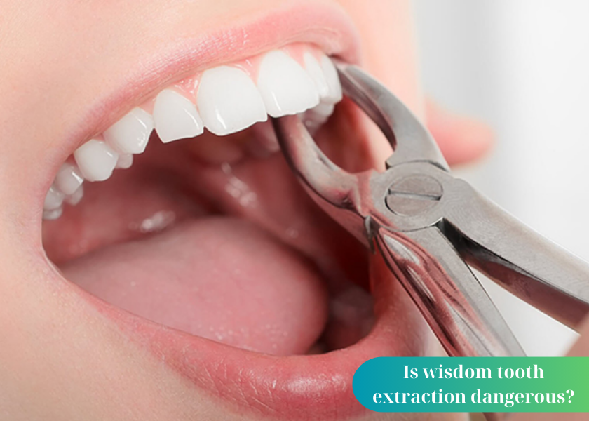 Is wisdom tooth extraction dangerous?