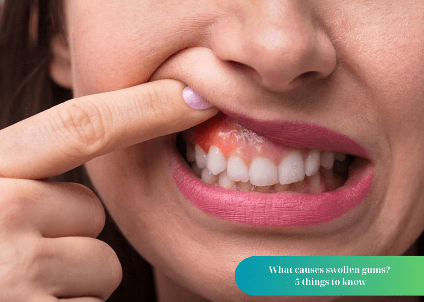 What causes swollen gums?