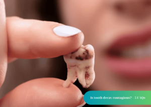 Is tooth decay contagious?