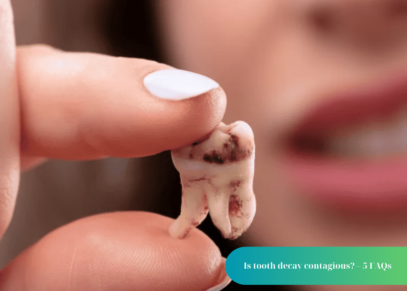 Is tooth decay contagious?