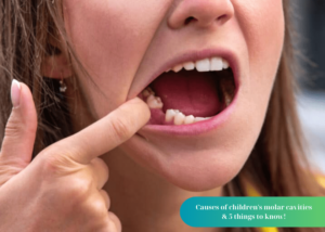 Causes of children's molar cavities & 5 things to know!