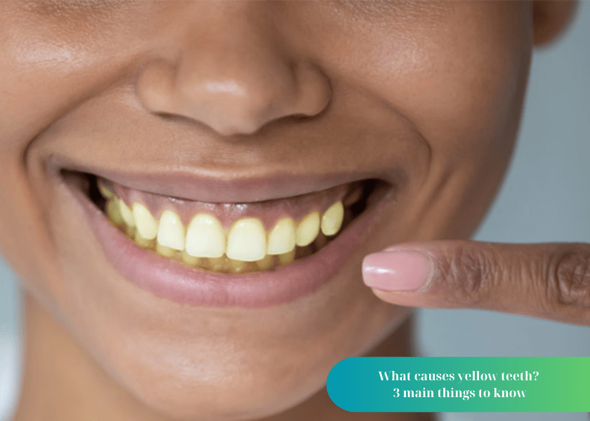 What causes yellow teeth?